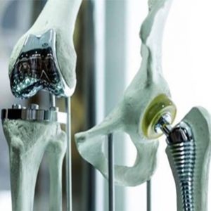 Rehabilitación y Recuperación de prótesis de rodilla y cadera En Segovia